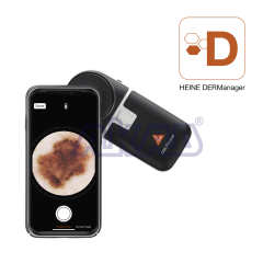 DERMATOSKOP DELTA ONE